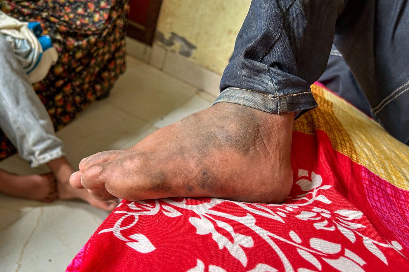 This is an image of Waseem's foot. 
